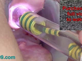 Endoscope máy ảnh trong peehole người phụ nữ tiểu lỗ thủng chơi.