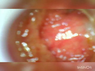 Usb endoscope 80 cm profond anal insertion, cochon film d2